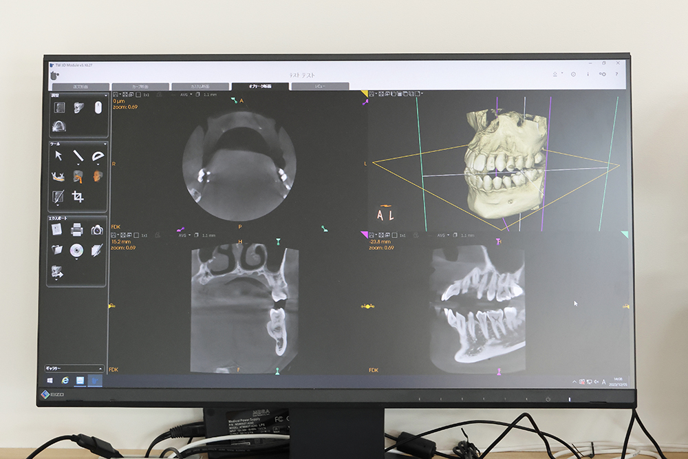 インビザラインGoの特徴について