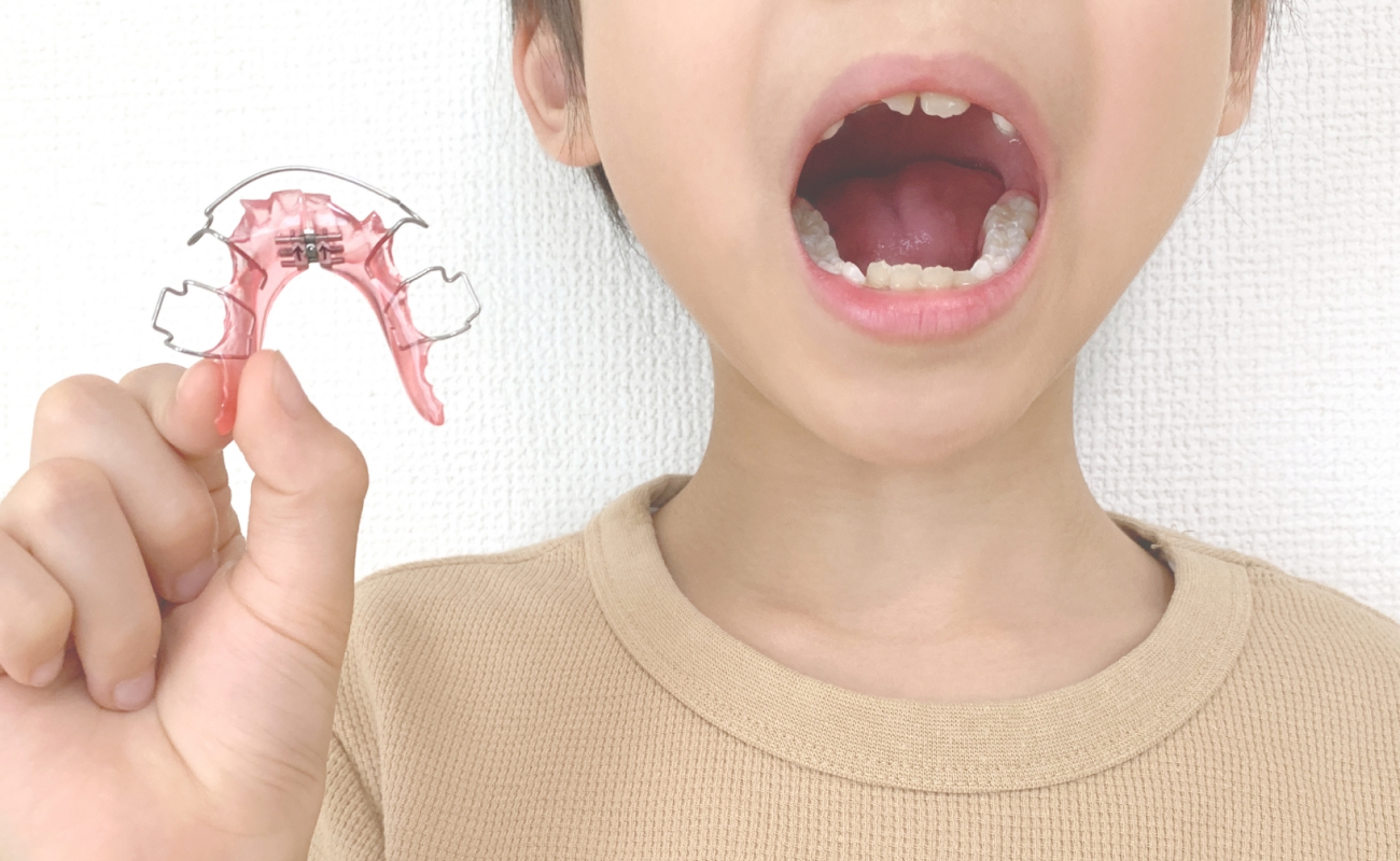 小児矯正について